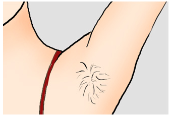 從毛茸茸到光滑如絲，最新脫毛價格指南，自信之旅啟程！