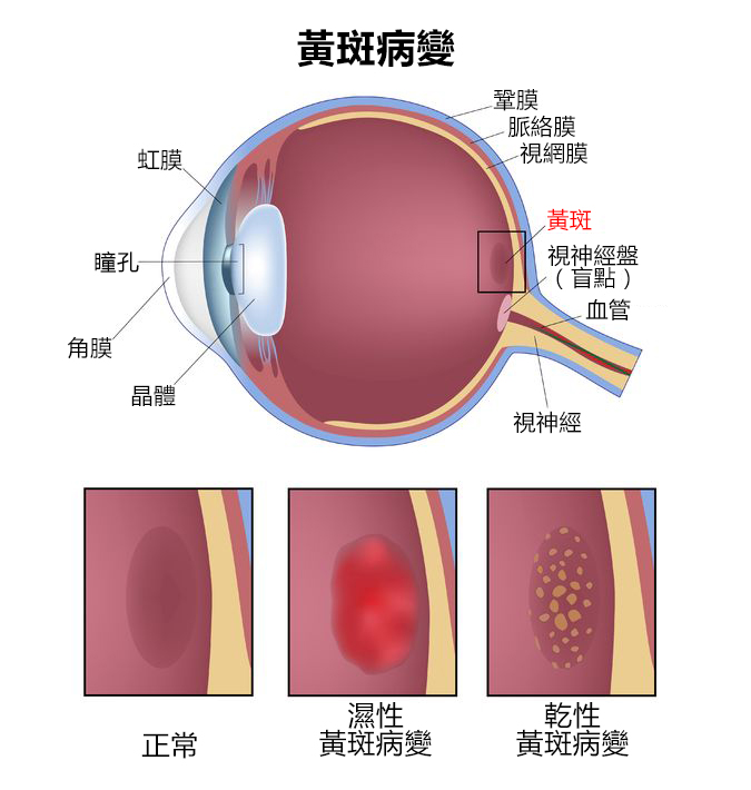 治療黃斑病變最新特效藥，自然美景的心靈探索之旅